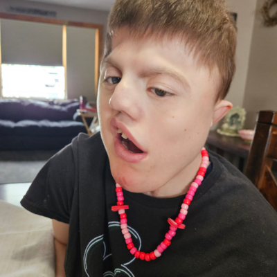 Teenage boy with CHARGE syndrome in a black shirt with a pink necklace. 