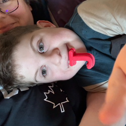 Young boy with CHARGE syndrome